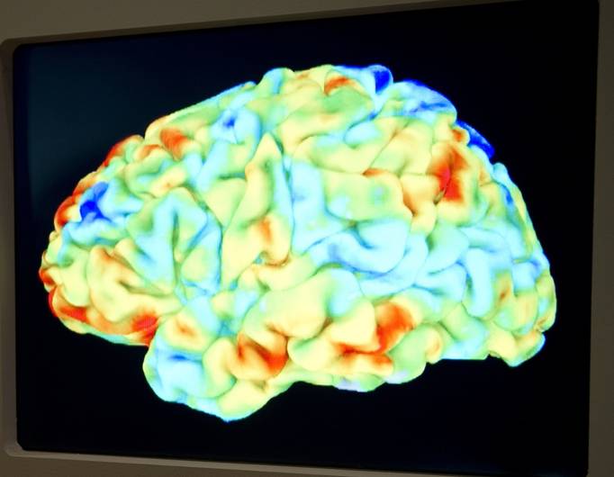 Une IRM du cerveau (image d'illustration)