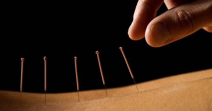 Une gamme de traditions curatives, y compris l'acupuncture, sont fondées sur le principe de l'existence de canaux d'énergie ou des voies.